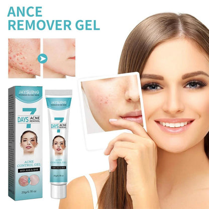 Crema facial acné tratamiento FK23B-39